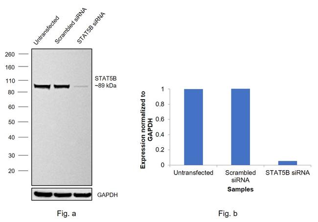 STAT5 alpha/beta Antibody in Western Blot (WB)