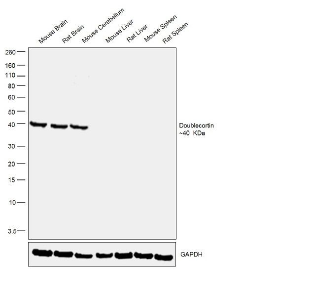 Doublecortin Antibody