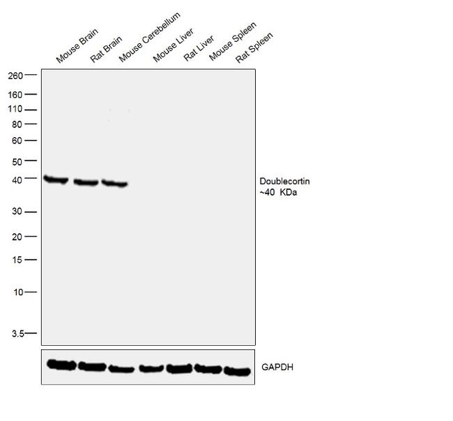 Doublecortin Antibody in Western Blot (WB)