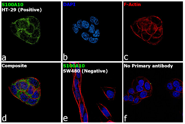 S100A10 Antibody