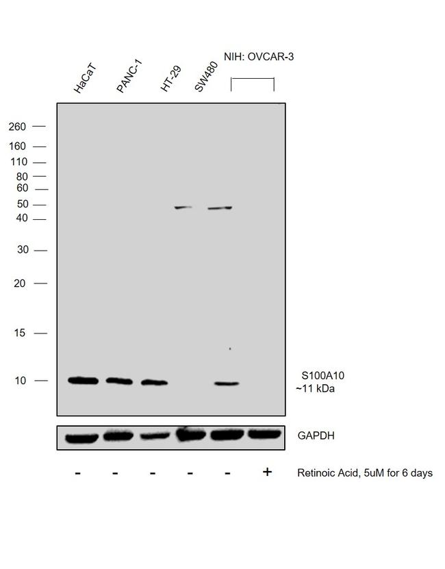 S100A10 Antibody in Western Blot (WB)