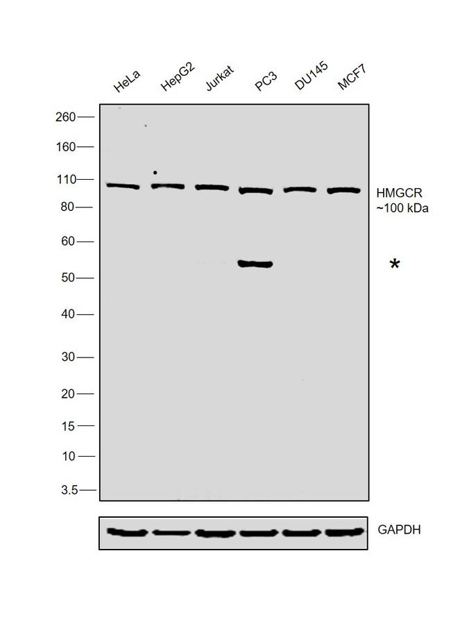 HMGCR Antibody in Western Blot (WB)