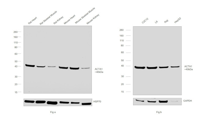 Actin Antibody