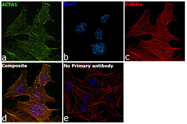 Actin Antibody in Immunocytochemistry (ICC/IF)