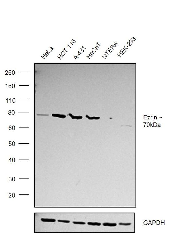 Ezrin Antibody in Western Blot (WB)