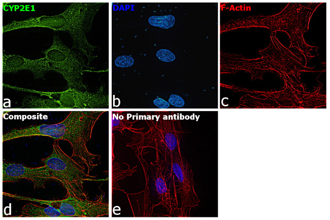 CYP2E1 Antibody in Immunocytochemistry (ICC/IF)