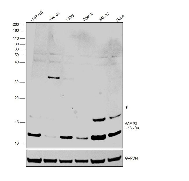 VAMP2 Antibody in Western Blot (WB)