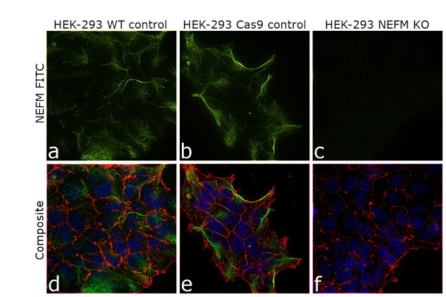 NEFM Antibody