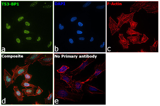 53BP1 Antibody in Immunocytochemistry (ICC/IF)