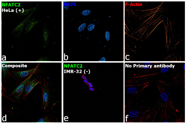 NFATC2 Antibody in Immunocytochemistry (ICC/IF)