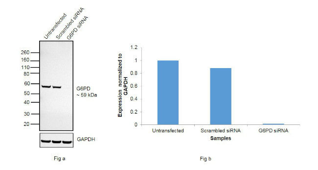 G6PD Antibody