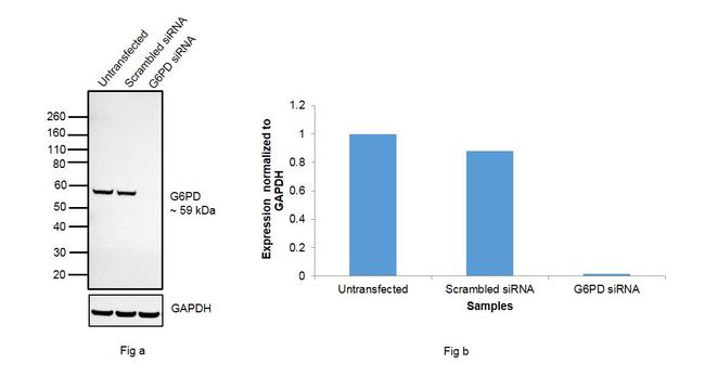 G6PD Antibody in Western Blot (WB)