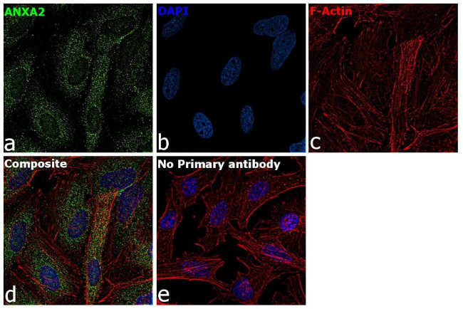 Annexin A2 Antibody in Immunocytochemistry (ICC/IF)