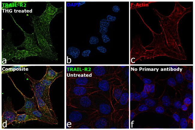 TRAIL-R2 (DR5) Antibody