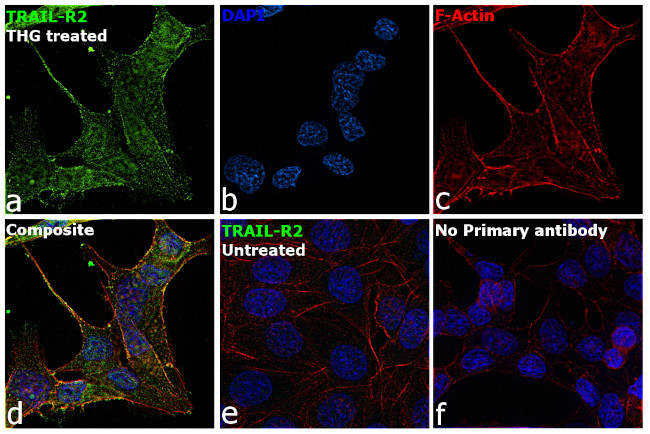 TRAIL-R2 (DR5) Antibody in Immunocytochemistry (ICC/IF)