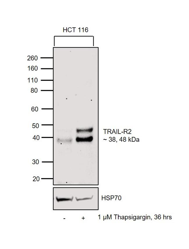 TRAIL-R2 (DR5) Antibody in Western Blot (WB)