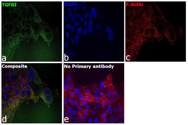 TGFBI Antibody in Immunocytochemistry (ICC/IF)