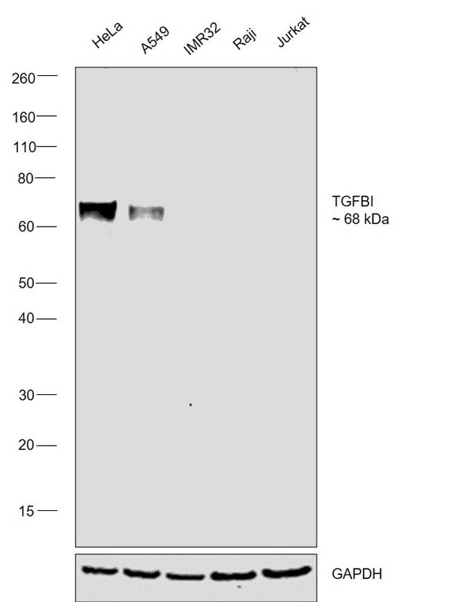 TGFBI Antibody in Western Blot (WB)