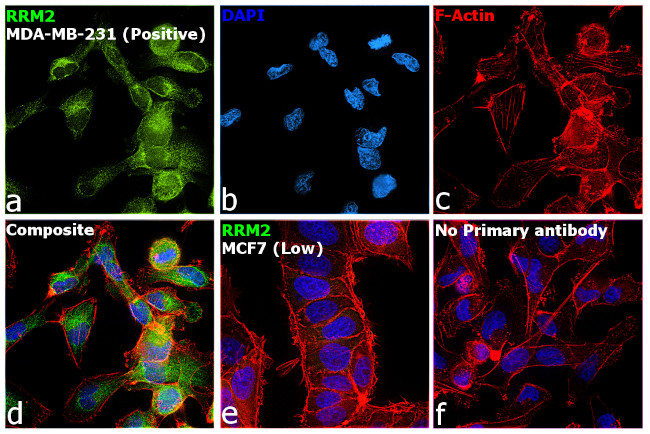 RRM2 Antibody in Immunocytochemistry (ICC/IF)