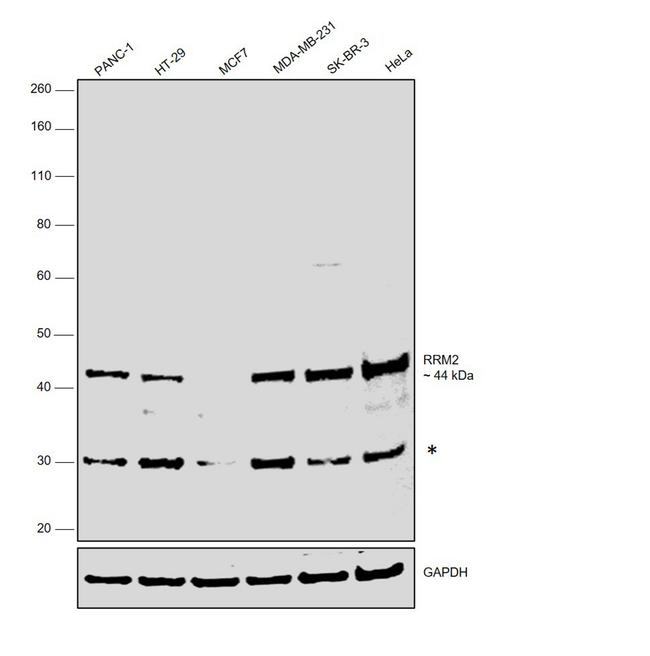 RRM2 Antibody in Western Blot (WB)