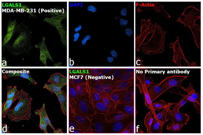 Galectin 1 Antibody in Immunocytochemistry (ICC/IF)