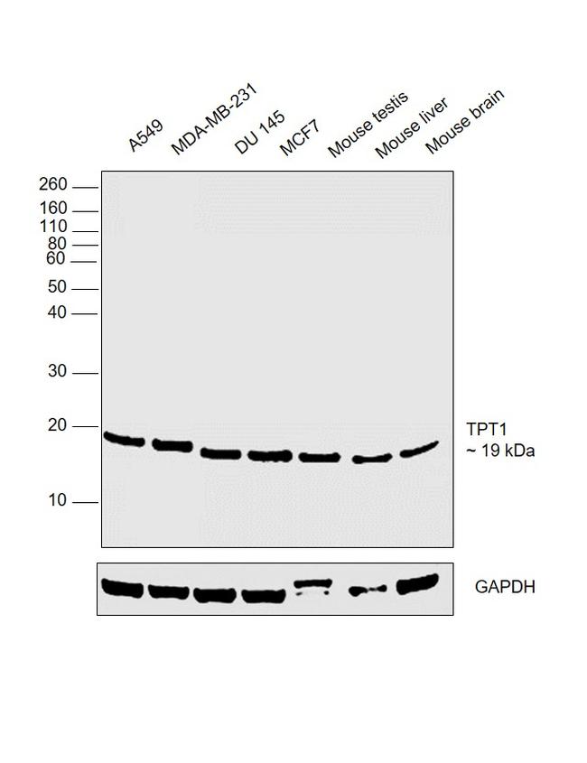 TPT1 Antibody in Western Blot (WB)