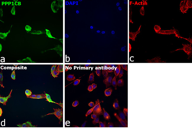 PP1 beta Antibody in Immunocytochemistry (ICC/IF)