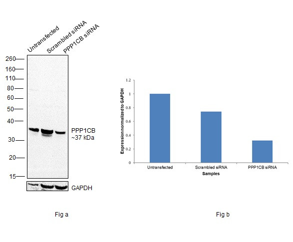 PP1 beta Antibody