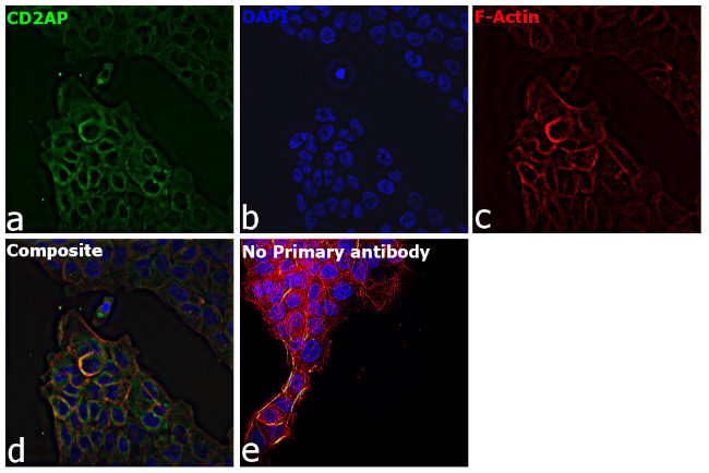 CD2AP Antibody in Immunocytochemistry (ICC/IF)