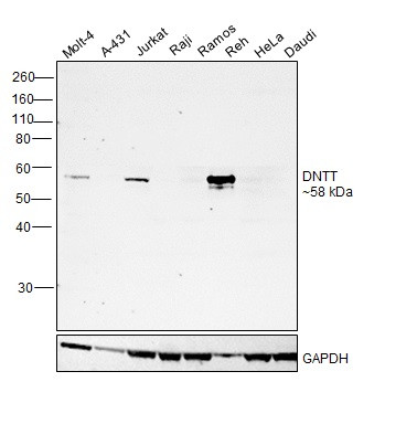 TdT Antibody