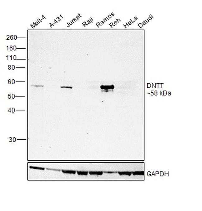 TdT Antibody in Western Blot (WB)