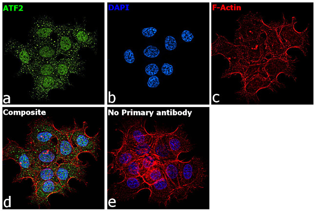 ATF2 Antibody in Immunocytochemistry (ICC/IF)