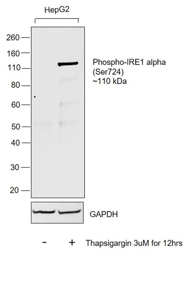 Phospho-IRE1 alpha (Ser724) Antibody in Western Blot (WB)