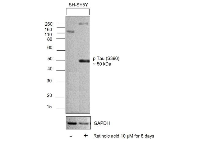 Phospho-Tau (Ser396) Antibody in Western Blot (WB)