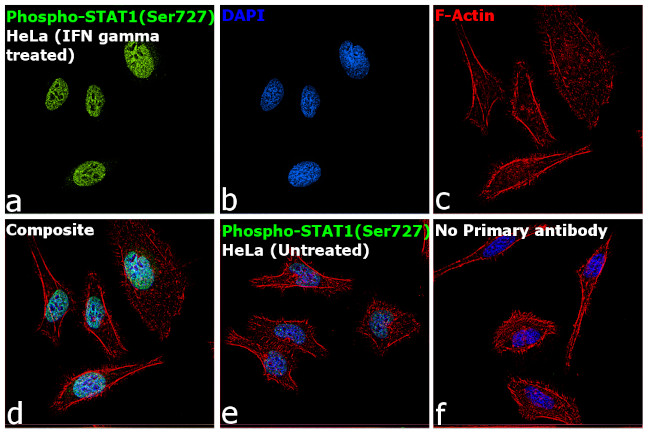 Phospho-STAT1 (Ser727) Antibody in Immunocytochemistry (ICC/IF)