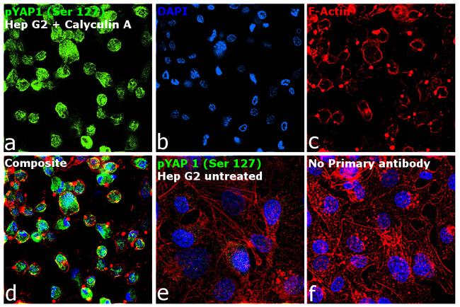 Phospho-YAP1 (Ser127) Antibody