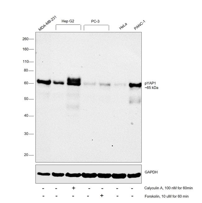 Phospho-YAP1 (Ser127) Antibody in Western Blot (WB)