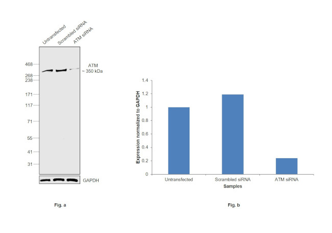 ATM Antibody