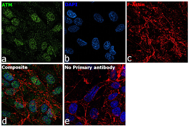 ATM Antibody in Immunocytochemistry (ICC/IF)