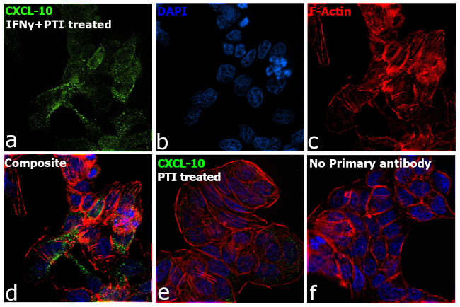 CXCL10 Antibody in Immunocytochemistry (ICC/IF)