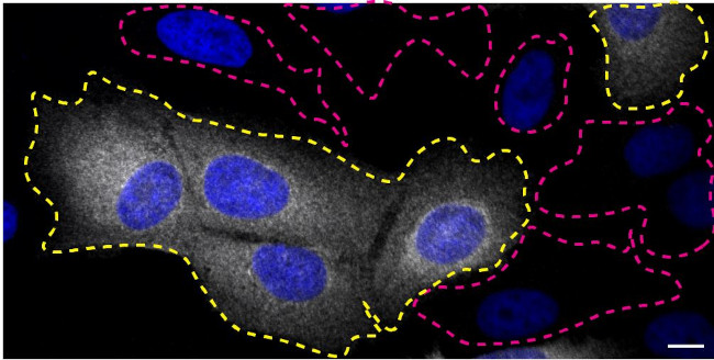 CHMP2B Antibody in Immunocytochemistry (ICC/IF)