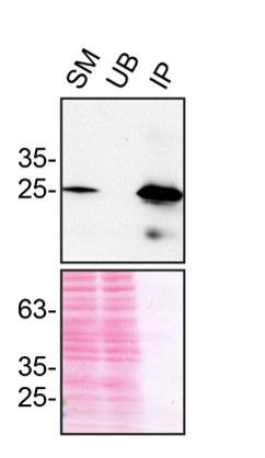 CHMP2B Antibody in Immunoprecipitation (IP)