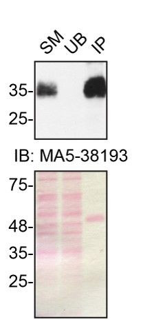 SFRP1 Antibody in Immunoprecipitation (IP)