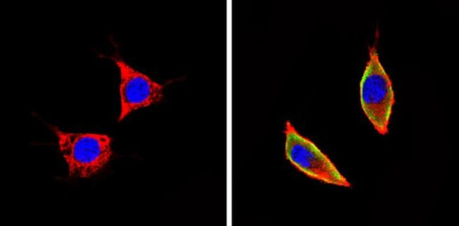 ICAM-1 Antibody in Immunocytochemistry (ICC/IF)