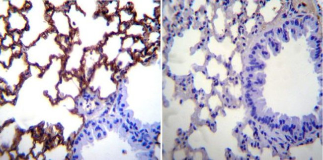 ICAM-1 Antibody in Immunohistochemistry (Paraffin) (IHC (P))