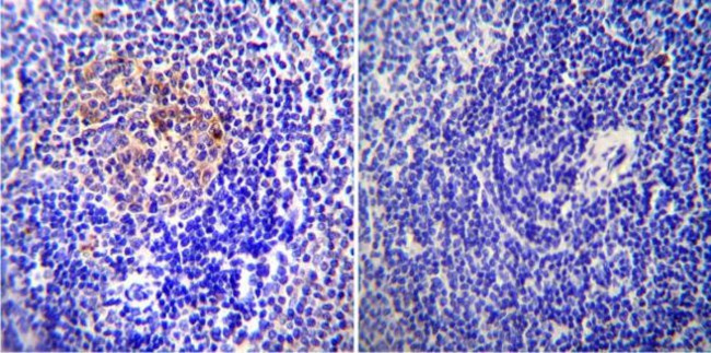 ICAM-1 Antibody in Immunohistochemistry (Paraffin) (IHC (P))