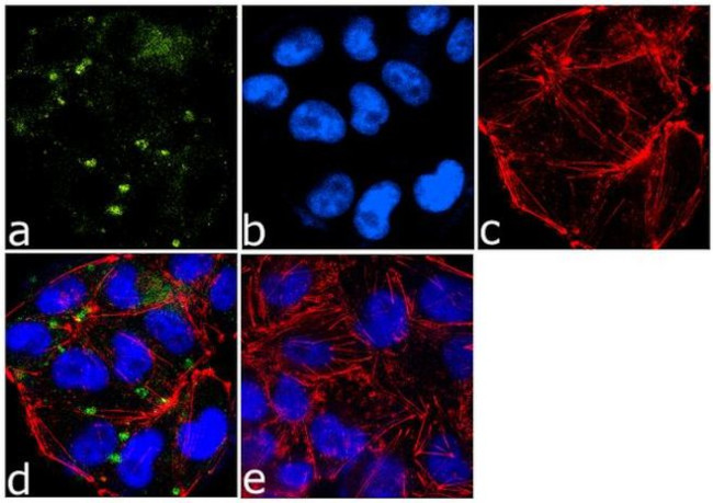 ICAM-1 Antibody in Immunocytochemistry (ICC/IF)