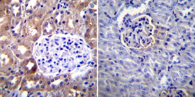 ICAM-1 Antibody in Immunohistochemistry (Paraffin) (IHC (P))