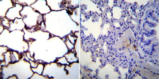 ICAM-1 Antibody in Immunohistochemistry (Paraffin) (IHC (P))