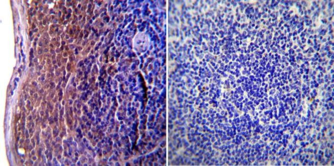 ICAM-1 Antibody in Immunohistochemistry (Paraffin) (IHC (P))